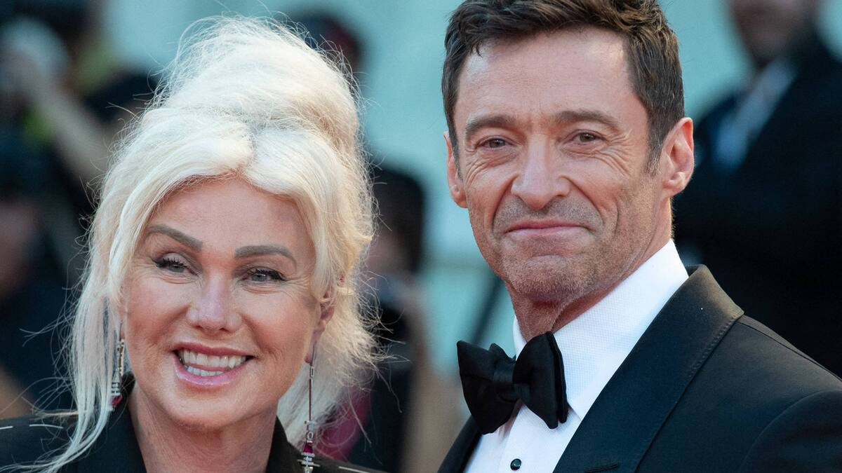Hugh Jackman dhe Deborra-Lee Furness: Divorci përfundimisht përmes
