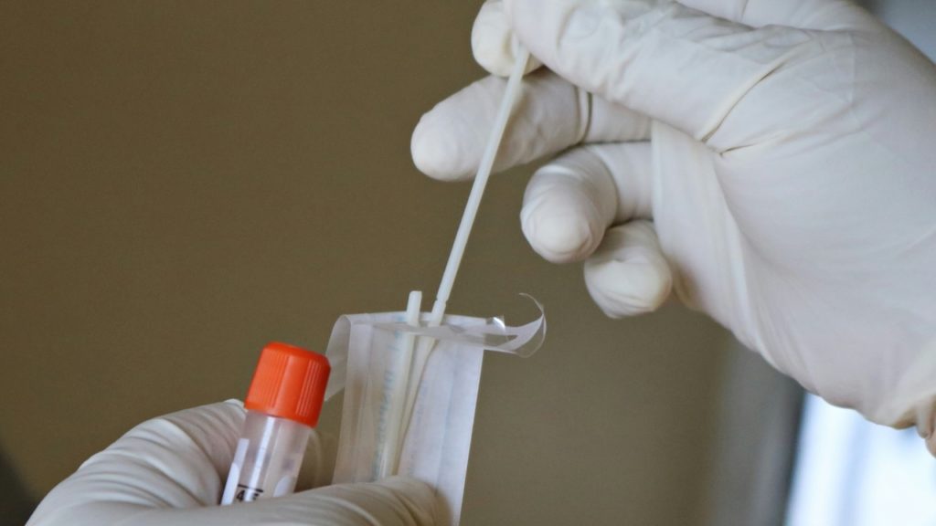 IKSHPK: Këtë vit u regjistruan 19 raste të reja me HIV/AIDS në Kosovë, një vdekje