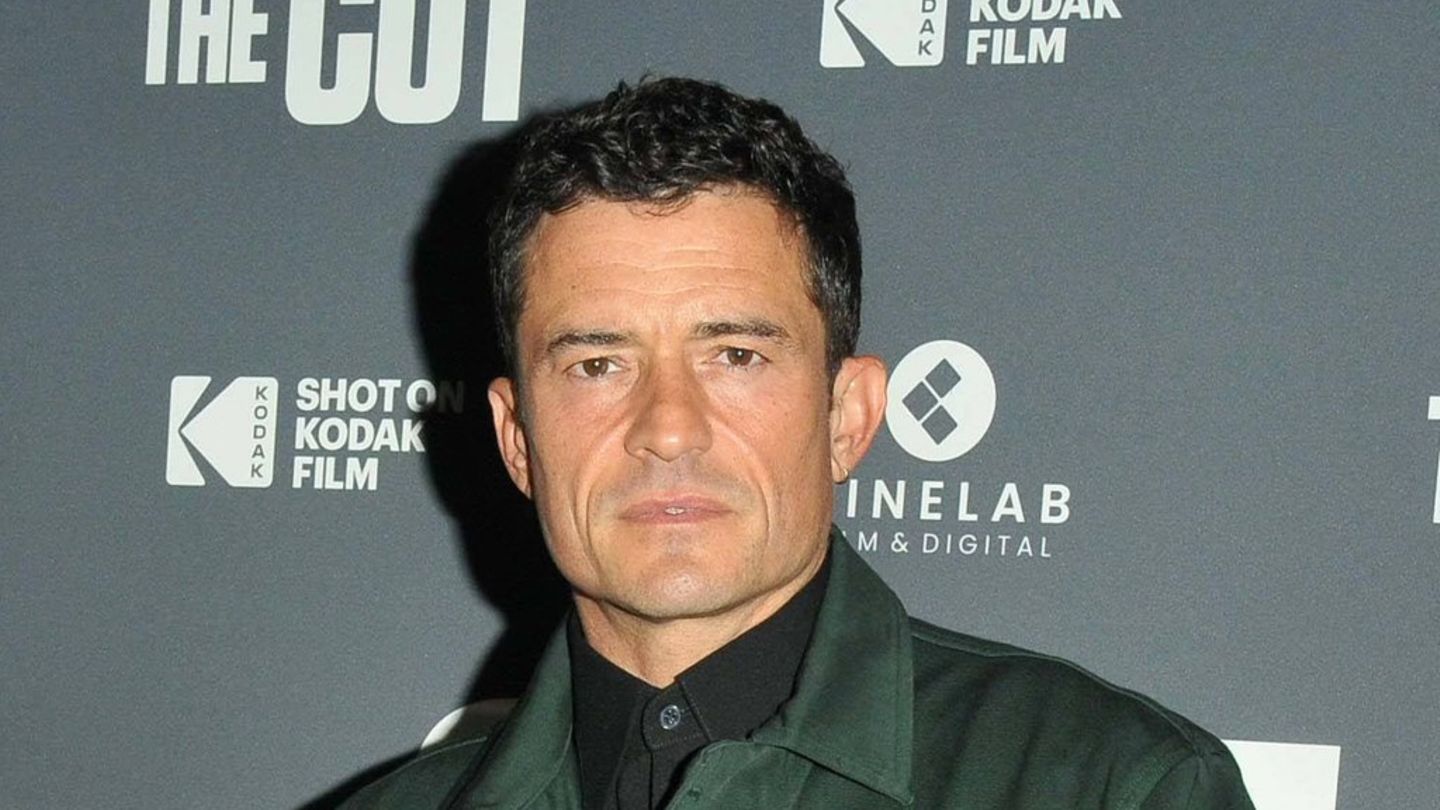Ai humbi 23 kilogramë për “prerjen”: Orlando Bloom ishte aq i ndyrë
