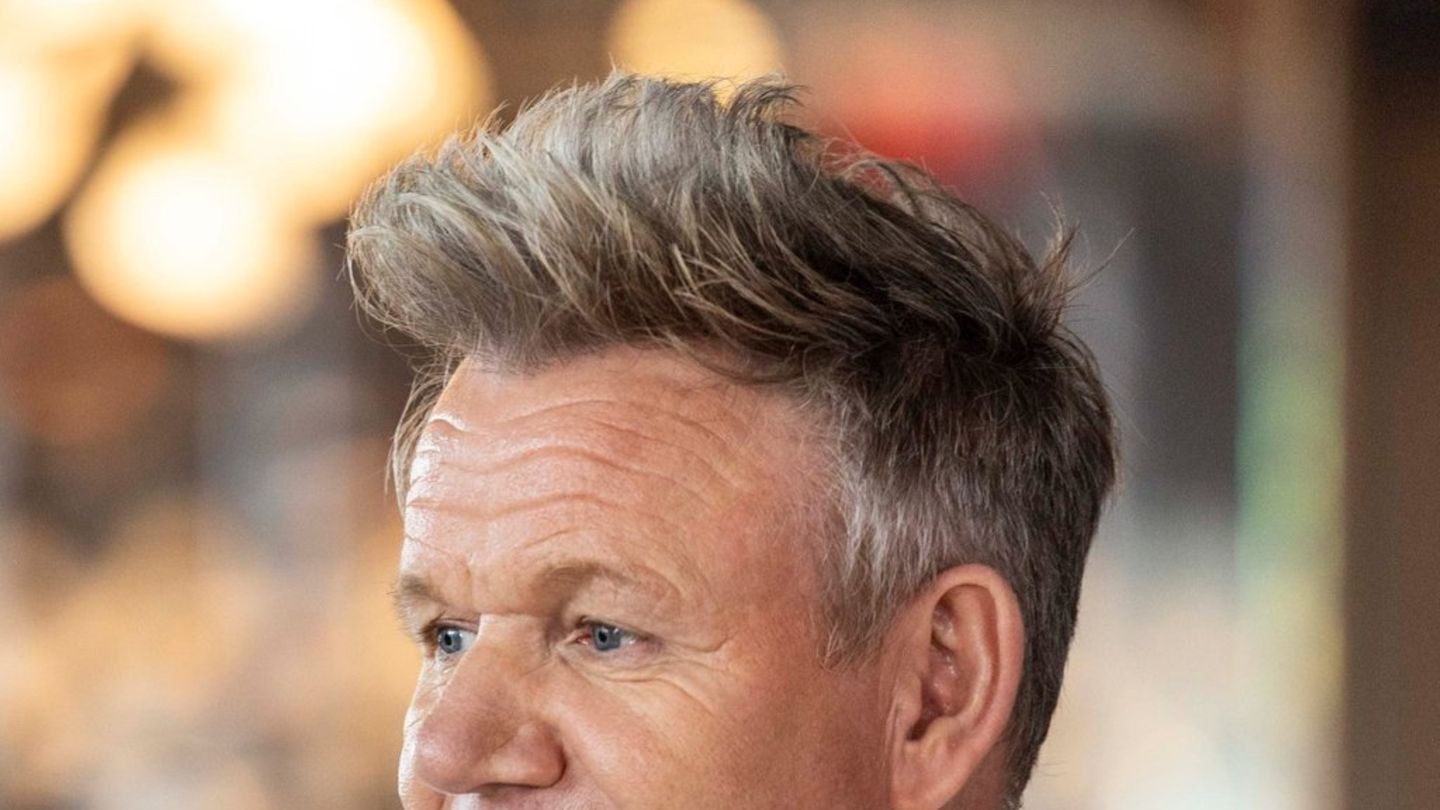 Gordon Ramsay: Karcinoma e qelizave bazale në një kuzhinier të madh të hequr